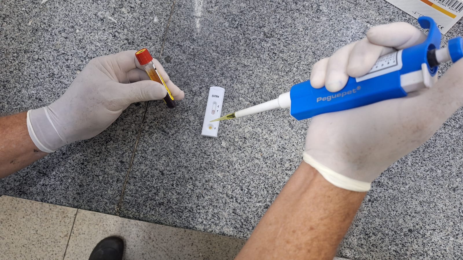 Goiás registra 7 mil casos de sífilis entre janeiro e agosto de 2026