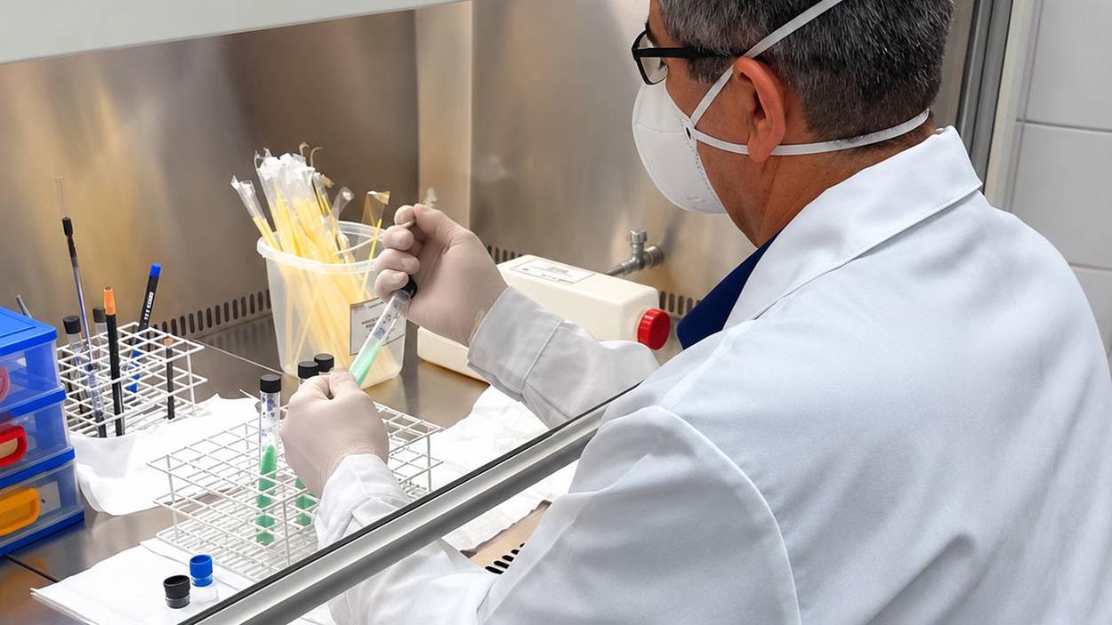 Nova técnica reduz custos e pode ampliar diagnóstico de tuberculose
