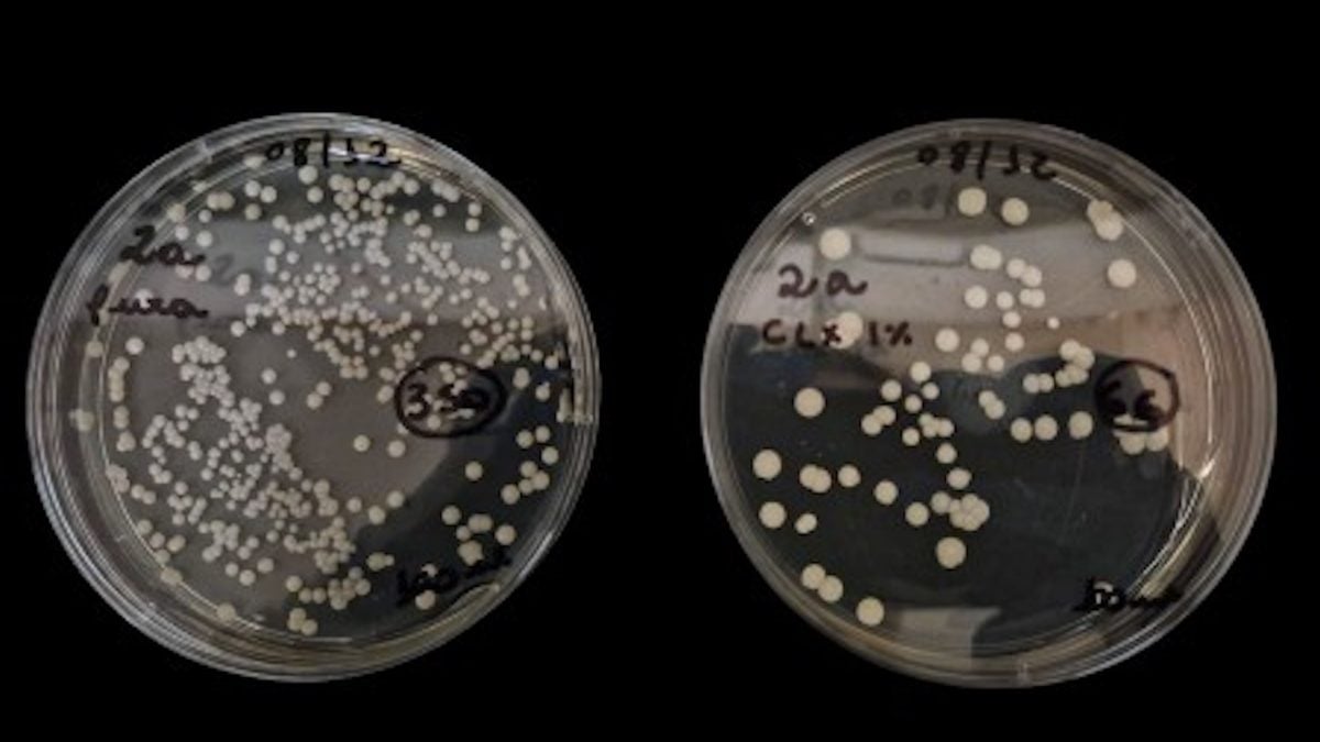 Antisséptico com clorexidina reduz resistência de fungo hospitalar em testes