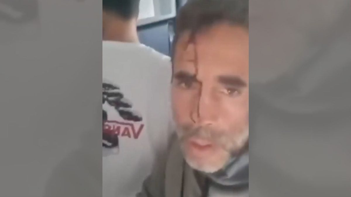 Passageiros socorrem piloto ferido em voo com destino a Israel após ataque do copiloto